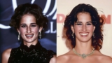 Celebrities With Braces Before and After