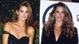 Celebrity Rhinoplasty Before and After