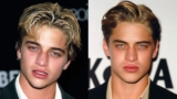 Celebrity Toupees Before and After